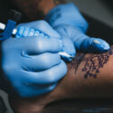 oodstranění tetování laserem